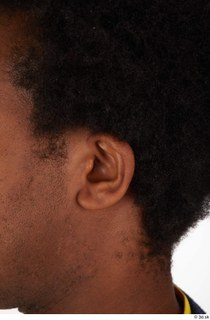 Photos of Allvince Epps ear 0001.jpg